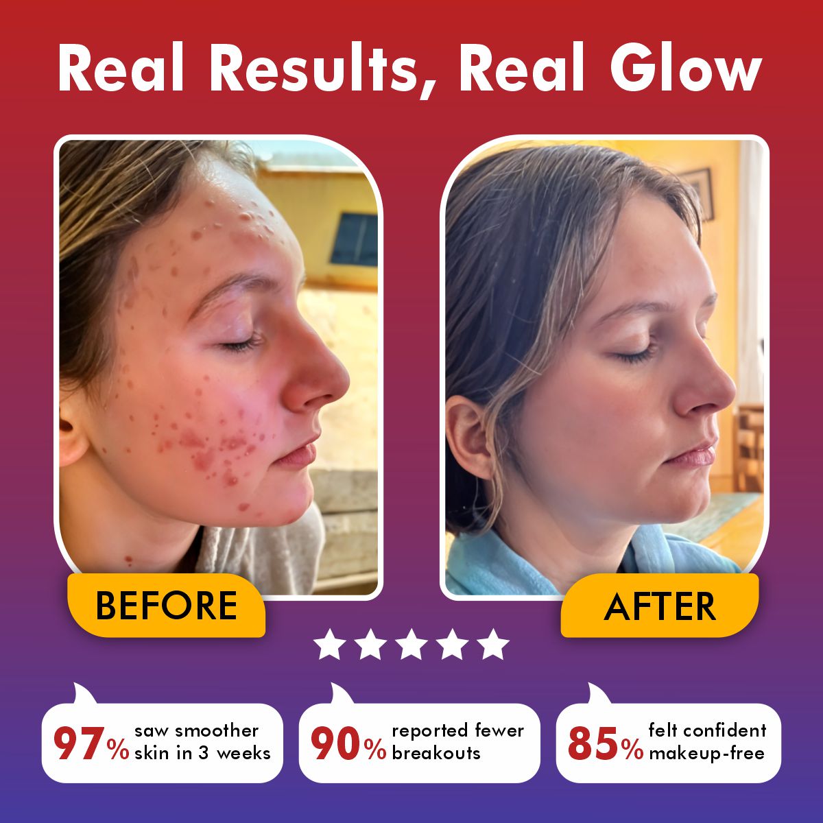 AuraGlow™ | LED Face Mask