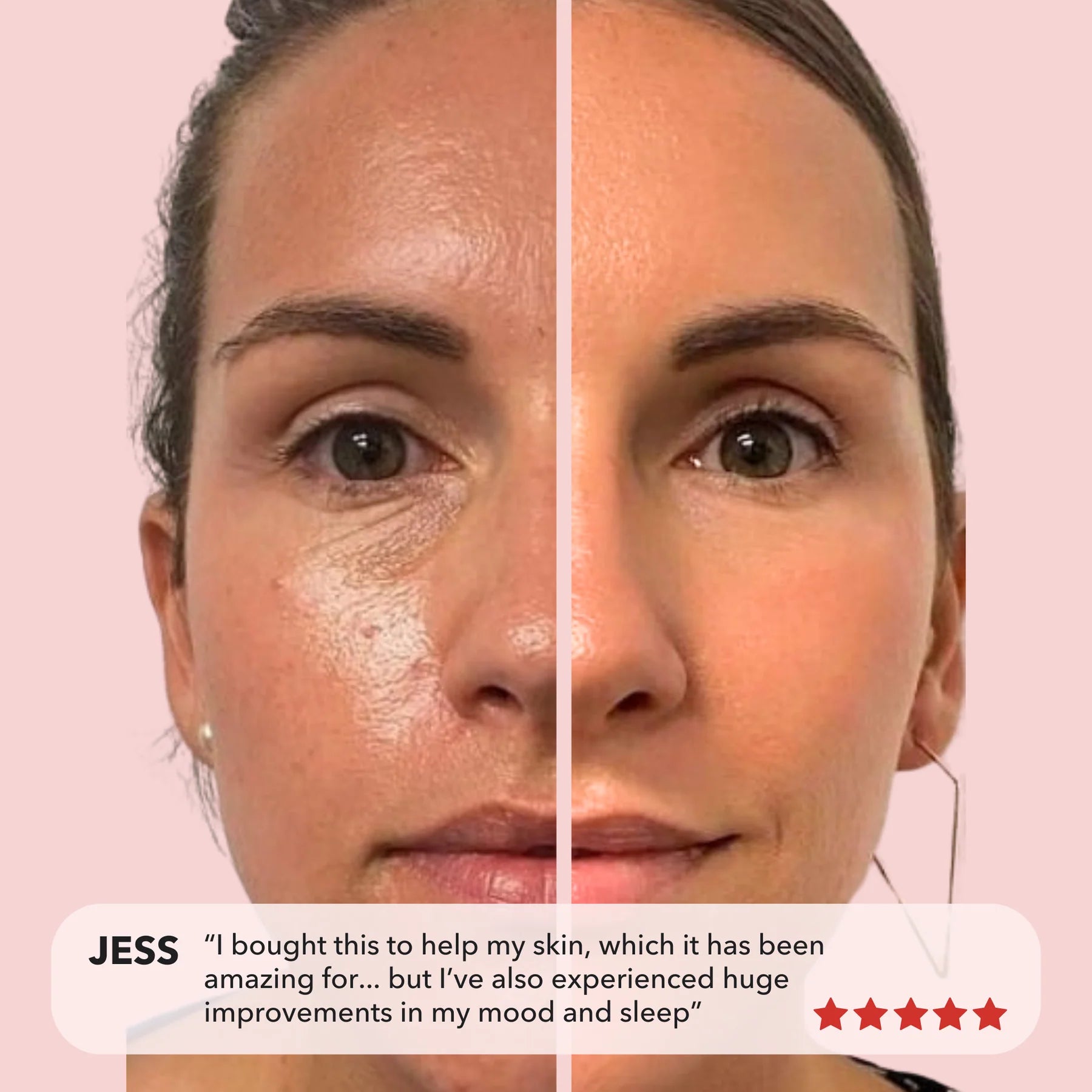 Radiance™ Pro | Red & Infrared Light Panel