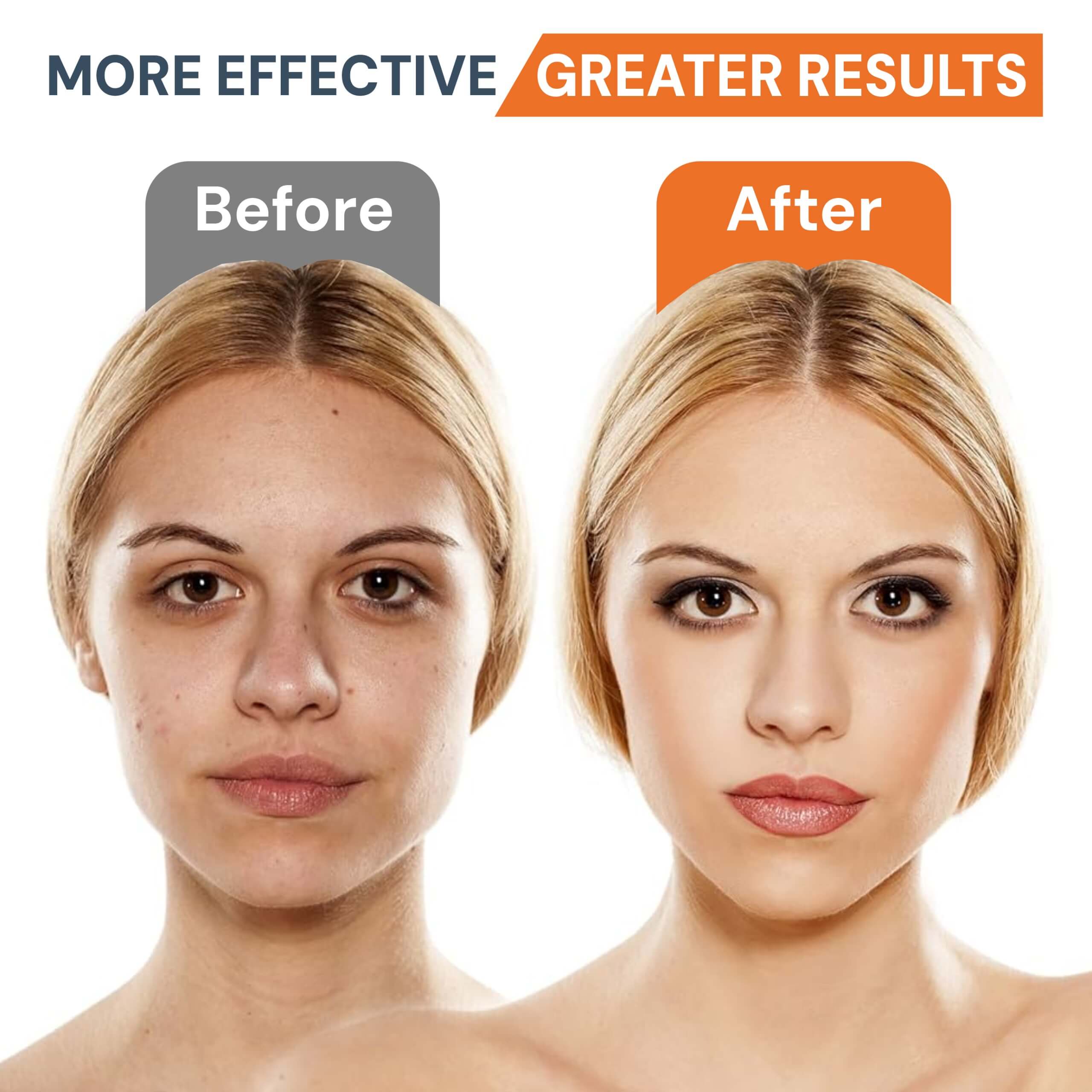 AuraSkin™ | LED Facial Sculptor