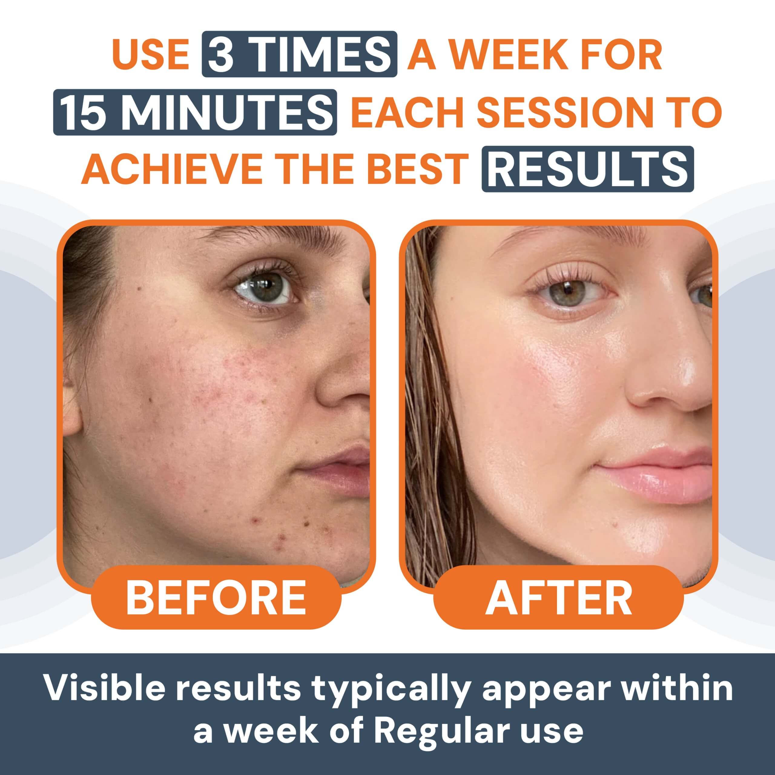 AuraSkin™ | LED Facial Sculptor