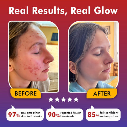 AuraGlow™ | LED Face Mask