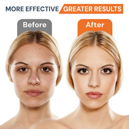 AuraSkin™ | LED Facial Sculptor