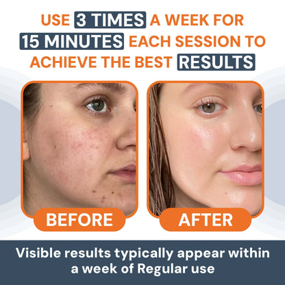 AuraSkin™ | LED Facial Sculptor