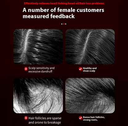 Scalp Massaging Brush – 3-in-1 Electric | Waterproof | Red Light Therapy